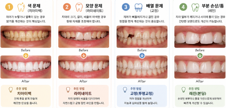 치아 임플란트 비용: 경제적인 선택을 위한 가이드