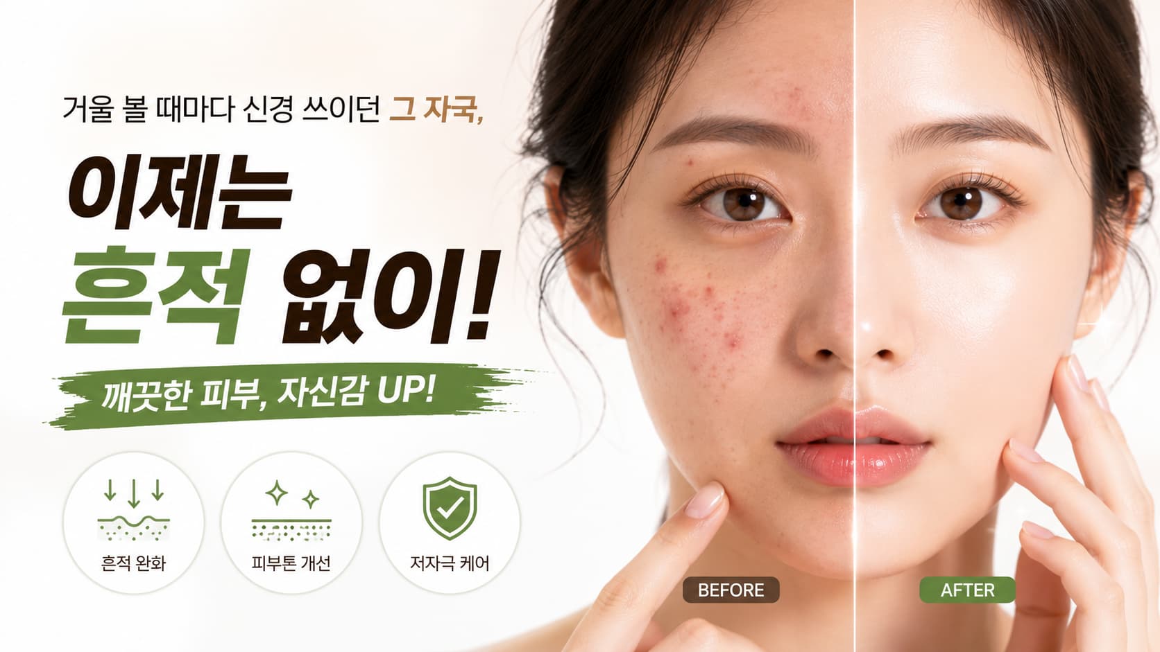 🌿 여드름 치료 비용, 왜 병원마다 다를까요? 같은 여드름 관리인데 가격 차이가 나는 이유