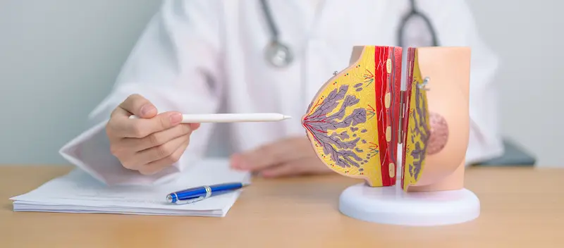 Effective Treatment for Breast Cancer Stage 1 & Latest Medical Guidance